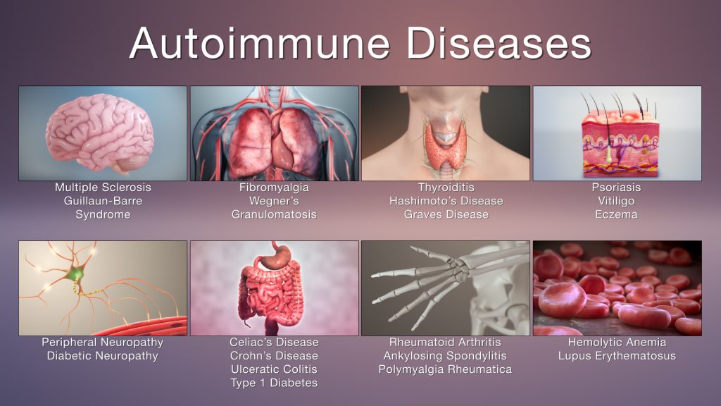 Autoimmune Diseases Therapies Market Size & Market Analysis